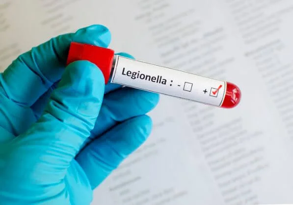 Basic Legionella Management