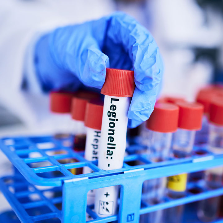 legionella-vial-handling